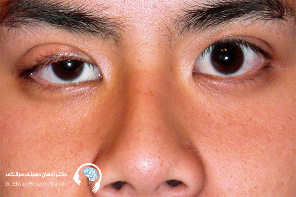 میاستنی گراویس